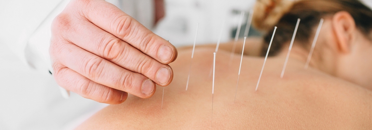 Acupuncturist inserting a needle into a female back. patient having traditional Chinese treatment using needles to restore an energy flow through specific points on the skin.